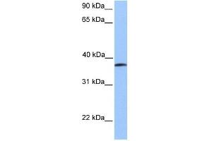 UBA5 antibody used at 1 ug/ml to detect target protein.
