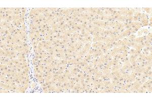 Detection of TRAF6 in Human Liver Tissue using Polyclonal Antibody to TNF Receptor Associated Factor 6 (TRAF6) (TRAF6 Antikörper  (AA 153-423))