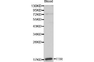 Western blot analysis of Blood cell lysate using TTR antibody. (TTR Antikörper  (AA 21-147))