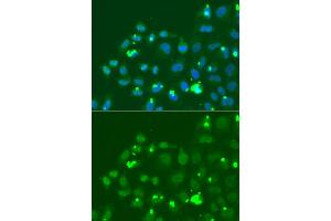 Immunofluorescence analysis of A549 cells using ATF3 antibody (ABIN6290025). (ATF3 Antikörper)