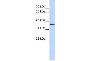 C8orf70 antibody used at 2. (FAM164A Antikörper  (Middle Region))