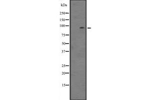 Western blot analysis of ZBTB33 expression in NIH3T3 whole cell lysate ;,The lane on the left is treated with the antigen-specific peptide. (ZBTB33 Antikörper  (N-Term))