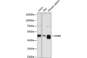 Western blot analysis of extracts of various cell lines, using HMBS antibody (ABIN3022529, ABIN3022530, ABIN3022531 and ABIN6218882) at 1:1000 dilution. (HMBS Antikörper  (AA 1-361))