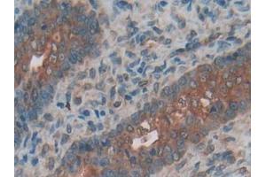 Immunohistochemistry (IHC) image for anti-Ectonucleotide Pyrophosphatase/phosphodiesterase 1 (ENPP1) (AA 568-793) antibody (ABIN1858719)