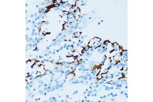 Immunohistochemistry of paraffin-embedded human tonsil using Cathepsin E (CTSE) antibody (ABIN3016440, ABIN3016441, ABIN3016442 and ABIN6219747) at dilution of 1:100 (40x lens). (Cathepsin E Antikörper)