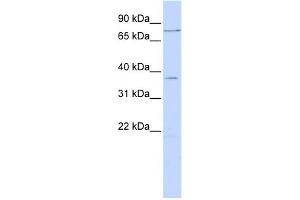 WB Suggested Anti-ZNF264 Antibody Titration:  0.