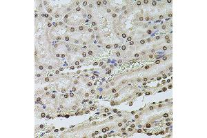 Immunohistochemistry (Paraffin-embedded Sections) (IHC (p)) image for anti-Histone Cluster 1, H2ag (HIST1H2AG) antibody (ABIN3068853)