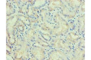 Immunohistochemical of paraffin-embedded human kidney tissue using ABIN7176818 at dilution of 1:200. (PLA2G7 Antikörper)