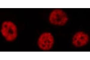Immunofluorescence (fixed cells) (IF/ICC) image for anti-serine/threonine Kinase 36 (STK36) (Internal Region) antibody (ABIN6259306)