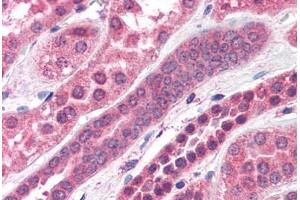 Human Kidney (formalin-fixed, paraffin-embedded) stained with STXBP6 antibody ABIN351472 at 3. (STXBP6 Antikörper  (AA 2-14))
