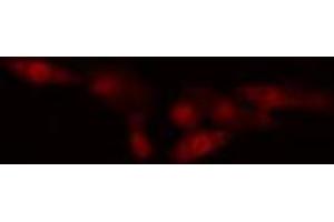 ABIN6274560 staining HeLa cells by IF/ICC. (Spindlin 1 Antikörper  (N-Term))
