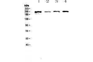 Western blot analysis of SCRIBBLE using anti-SCRIBBLE antibody . (SCRIB Antikörper  (AA 172-409))