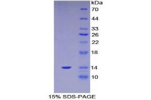 SDS-PAGE analysis of Human S100A11 Protein. (S100A11 Protein)