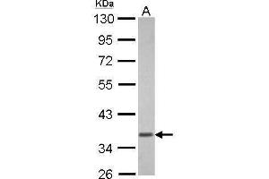 Western Blotting (WB) image for anti-Guanine Nucleotide Binding Protein (G Protein), alpha Transducing Activity Polypeptide 1 (GNAT1) (Center) antibody (ABIN2856227)