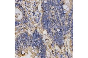 Immunohistochemistry (IHC) image for anti-Chloride Channel 5 (CLCN5) antibody (ABIN1876908) (Chloride Channel 5 Antikörper)