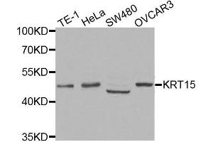 Western blot analysis of extracts of various cell lines, using KRT15 antibody. (KRT15 Antikörper)