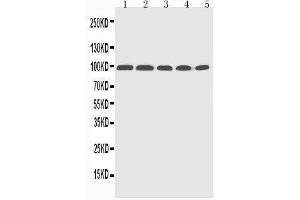 Western Blotting (WB) image for anti-Progesterone Receptor (PGR) (AA 595-933) antibody (ABIN3042523)