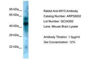 Image no. 1 for anti-Kruppel-Like Factor 15 (KLF15) (N-Term) antibody (ABIN6749944) (KLF15 Antikörper  (N-Term))