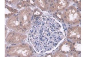 DAB staining on IHC-P; Samples: Human Kidney Tissue (PC Antikörper  (AA 36-486))