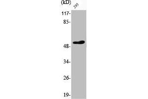 Western Blot analysis of 293 cells using Phospho-ATF-2 (T73) Polyclonal Antibody (ATF2 Antikörper  (pThr73))