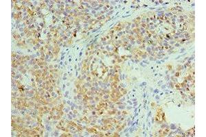 Immunohistochemistry of paraffin-embedded human tonsil tissue using ABIN7171432 at dilution of 1:100 (CCT6A Antikörper  (AA 80-250))