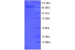 SDS-PAGE (SDS) image for Fucose-1-Phosphate Guanylyltransferase (FPGT) (AA 1-594), (full length) protein (His tag) (ABIN5713458) (FPGT Protein (AA 1-594, full length) (His tag))