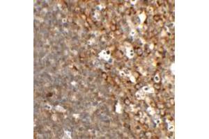 Immunohistochemistry of TFCP2L1 in rat colon tissue with TFCP2L1 antibody at 2.