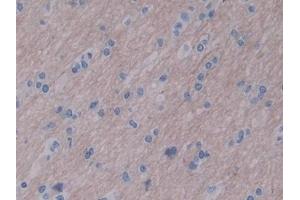 Immunohistochemistry (IHC) image for anti-Wingless-Type MMTV Integration Site Family, Member 16 (WNT16) (AA 30-365) antibody (ABIN7443245)