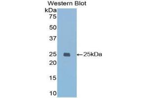 Western Blotting (WB) image for anti-Insulin-Like Growth Factor Binding Protein 7 (IGFBP7) (AA 88-281) antibody (ABIN1859314)