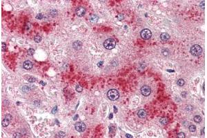 Human Liver (formalin-fixed, paraffin-embedded) stained with LEPR antibody ABIN364407 at 4 ug/ml followed by biotinylated anti-goat IgG secondary antibody ABIN481715, alkaline phosphatase-streptavidin and chromogen. (Leptin Receptor Antikörper  (AA 829-841))