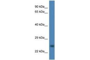 Image no. 1 for anti-Copper Chaperone For Superoxide Dismutase (CCS) (AA 126-175) antibody (ABIN6746930) (Superoxide dismutase copper chaperone Antikörper  (AA 126-175))