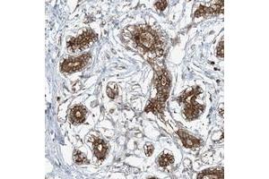 Immunohistochemical staining of human breast with COMMD8 polyclonal antibody  strong cytoplasmic positivity in glandular cells at 1:50-1:200 dilution. (COMMD8 Antikörper)