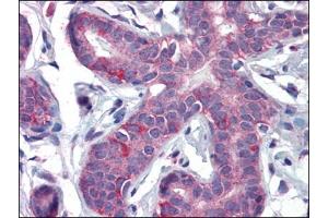 Immunohistochemistry Image: Human Breast: Formalin-Fixed, Paraffin-Embedded (FFPE) (PPARD Antikörper  (C-Term))
