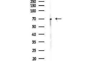 Western blot analysis of lysates from Rat lung, using SCNN1B Antibody at 1/1000 dilution.