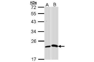 WB Image Sample (30 ug of whole cell lysate) A: H1299 B: Molt-4 , 12% SDS PAGE antibody diluted at 1:1000 (CRP Antikörper)