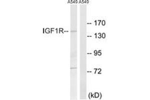 Western blot analysis of extracts from A549 cells, using IGF1R (Ab-1346) Antibody. (IGF1R Antikörper  (AA 1311-1360))