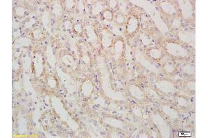 Formalin-fixed and paraffin embedded mouse kidney labeled with Rabbit Anti SARM1 Polyclonal Antibody, Unconjugated (ABIN1387556) at 1:200 followed by conjugation to the secondary antibody and DAB staining (SARM1 Antikörper  (AA 340-380))