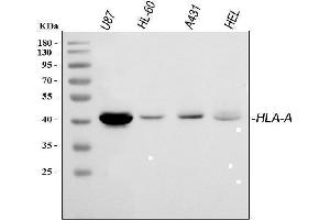anti-Major Histocompatibility Complex, Class I, A (HLA-A) (AA 82-106), (N-Term) antibody