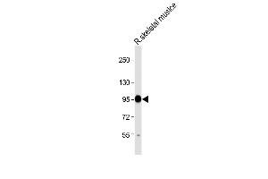 Anti-CO Antibody (Center) at 1:2000 dilution + Rat skeletal muslce lysate Lysates/proteins at 20 μg per lane. (COMP Antikörper  (AA 314-343))