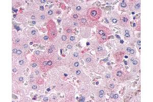 Anti-MKP-8 / DUSP26 antibody IHC of human liver. (DUSP26 Antikörper  (Internal Region))