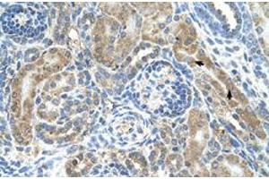 Immunohistochemical staining (Formalin-fixed paraffin-embedded sections) of human kidney with CRELD1 polyclonal antibody  at 4-8 ug/mL working concentration. (CRELD1 Antikörper  (C-Term))