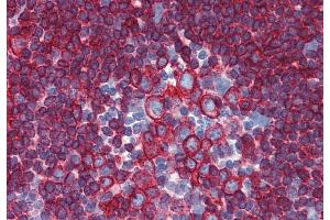 Immunohistochemistry staining of human small intestine (paraffin-embedded sections) with anti-HLA-DR+DP (HL-40). (HLA-DP/DR Antikörper)