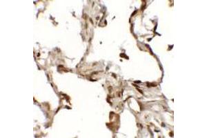 Immunohistochemistry of TFEB (NT) in human lung tissue with TFEB (NT) antibody at 2. (TFEB Antikörper  (N-Term))