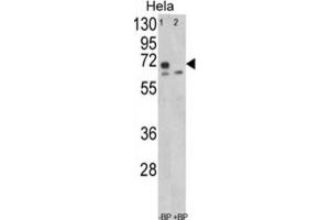 Western Blotting (WB) image for anti-Leiomodin 1 (LMOD1) antibody (ABIN3003829) (Leiomodin 1 Antikörper)