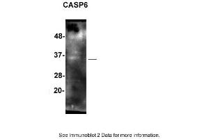 Sample: SH-SY5Y cells  2. (Caspase 6 Antikörper  (Middle Region))