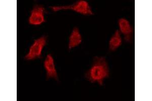 ABIN6272449 staining 293 by IF/ICC. (TRF1 Antikörper  (Internal Region))
