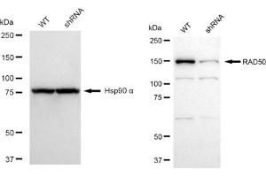 Western blotting analysis using RAD50 antibody (ABIN7800119). (Rekombinanter RAD50 Antikörper)