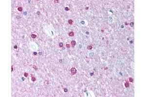 Anti-CACNB1 antibody IHC of human brain, cortex, white matter.