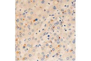 ABIN6278065 at 1/100 staining human liver tissue sections by IHC-P. (ORAI1 Antikörper  (C-Term))