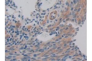 Detection of PDHX in Mouse Ovary Tissue using Polyclonal Antibody to Pyruvate Dehydrogenase Complex Component X (PDHX)